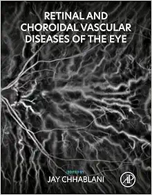 Retinal And Choroidal Vascular Diseases Of The Eye (PDF)