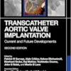 Transcatheter Aortic Valve Implantation: Current And Future Developments, 2nd Edition (PDF)