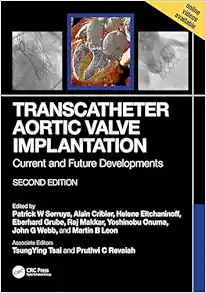 Transcatheter Aortic Valve Implantation: Current And Future Developments, 2nd Edition (PDF)