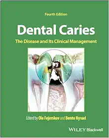 Dental Caries: The Disease And Its Clinical Management, 4th Edition (PDF)