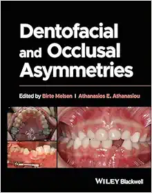 Dentofacial And Occlusal Asymmetries (PDF)