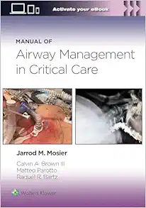 Manual Of Airway Management In Critical Care (EPUB)