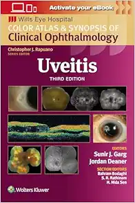 Uveitis: Color Atlas And Synopsis Of Clinical Ophthalmology (Wills Eye Institute Atlas Series), 3ed (EPUB)