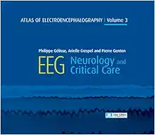 Atlas Of Electroencephalography : EEG Neurology And Critical Care, Volume 3 (PDF)