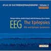 Atlas Of Electroencephalography:The Epilepsies. EEG And Epileptic Syndromes, Volume 2 (PDF)