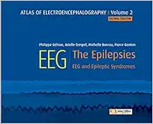 Atlas Of Electroencephalography:The Epilepsies. EEG And Epileptic Syndromes, Volume 2 (PDF)