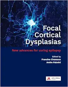 Focal Cortical Dysplasias: New Advances For Curing Epilepsy (PDF)