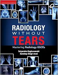 Radiology Without Tears: Mastering Radiology OSCEs (PDF)