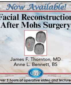 Facial Reconstruction After Mohs Surgery (QMP 2024)