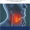 Head And Neck Cancer: Clinical Aspects (PDF)