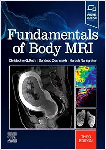 Fundamentals Of Body MRI (Fundamentals Of Radiology), 3rd Edition (EPUB)