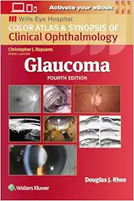 Glaucoma_ Color Atlas And Synopsis Of Clinical Ophthalmology, 4th Edition (Wills Eye Institute Atlas Series) (EPUB)