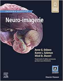 Neuro-Imagerie – Collection Imagerie Médicale Amirsys – Osborn (PDF)