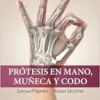 Prótesis En Mano, Muñeca Y Codo (PDF)