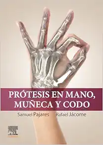 Prótesis En Mano, Muñeca Y Codo (PDF)