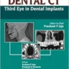 Dental CT: Third Eye In Dental Implants (PDF)