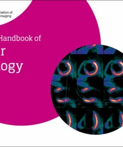 EACVI Handbook Of Nuclear Cardiology (PDF)