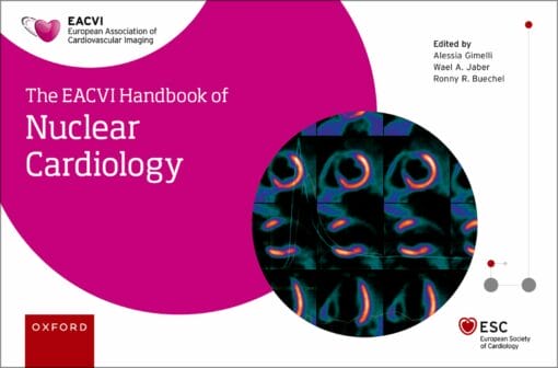 EACVI Handbook Of Nuclear Cardiology (PDF)