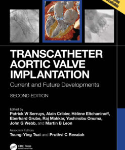 Transcatheter Aortic Valve Implantation: Current And Future Developments, 2nd Edition (EPUB)