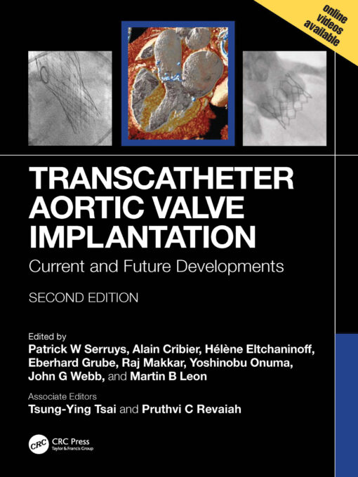 Transcatheter Aortic Valve Implantation: Current And Future Developments, 2nd Edition (EPUB)