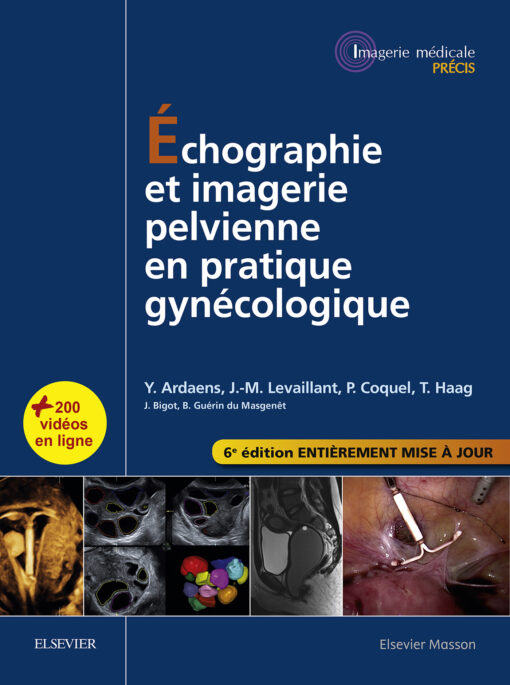 Échographie Et Imagerie Pelvienne En Pratique Gynécologique, 6th Edition (PDF)