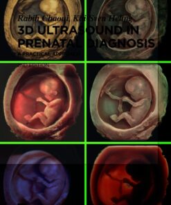 3D Ultrasound In Prenatal Diagnosis – A Practical Approach, 2nd Edition (EPUB)