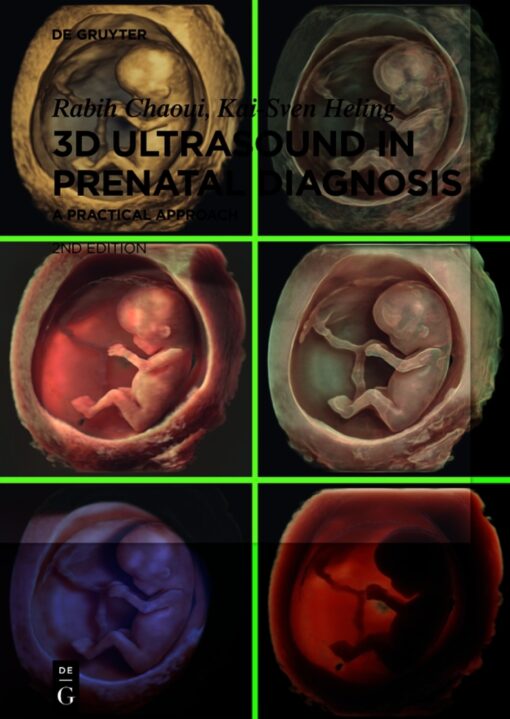 3D Ultrasound In Prenatal Diagnosis – A Practical Approach, 2nd Edition (EPUB)