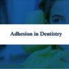 SPEAR Adhesion in Dentistry