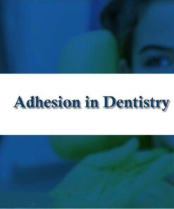 SPEAR Adhesion in Dentistry