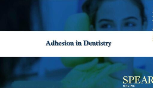 SPEAR Adhesion in Dentistry