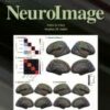 NeuroImage PDF