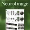 NeuroImage PDF