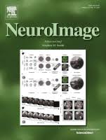 NeuroImage PDF