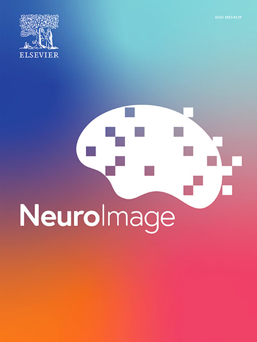 NeuroImage PDF