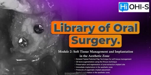 OHI-S Library of Oral Surgery, Module 2 Soft Tissue Management and Implantation in the Aesthetic Zone