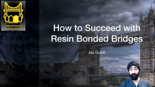 RBB MasterClass,How to Succeed with Resin Bounded Bridges-Jazz Gulati