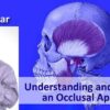 SPEAR Understanding and Choosing an Occlusal Appliance – Frank Spear