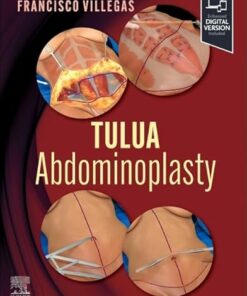 TULUA Abdominoplasty: Transverse Plication Technique 1st Edition (PDF)