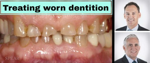 Spear : Treating worn dentition 2021