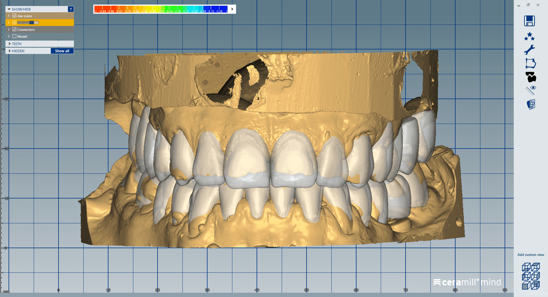 Advanced EXOCAD for All the Things AOX