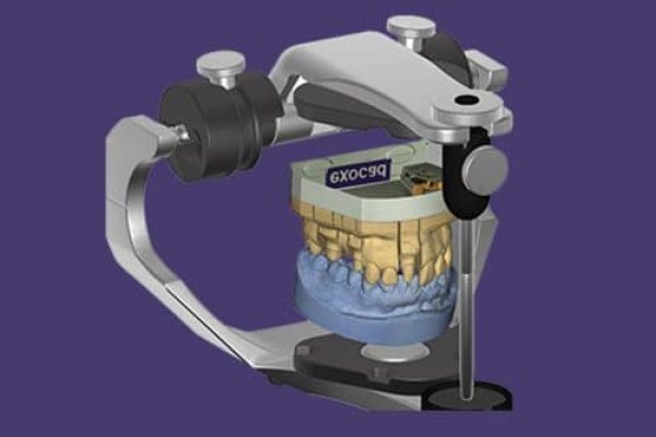 Advanced EXOCAD for All the Things AOX