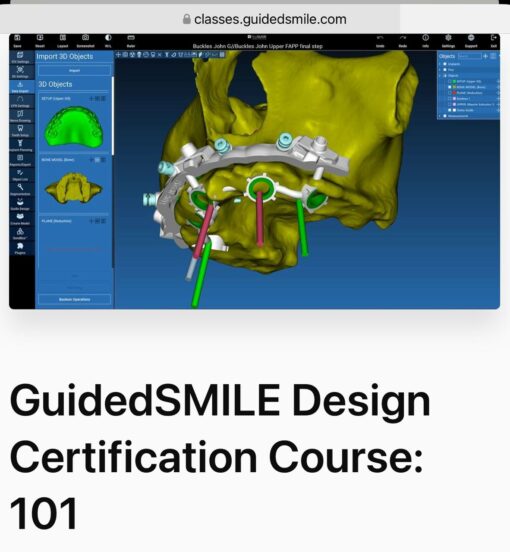 GuidedSMILE Design Certification Course: 101