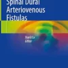 Intracranial And Spinal Dural Arteriovenous Fistulas (PDF)