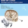 Práticas Em Cirurgia Da Base De Crânio: Abordagens Para Base Anterior E Lateral (Portuguese Edition) (AZW3 + EPUB)