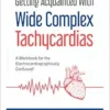 Getting Acquainted With Wide Complex Tachycardias: A Workbook For The Electrocardiographically Confused! (EPUB)