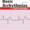 Basic Arrhythmias With 12-Lead EKGs, 9th Edition (PDF)