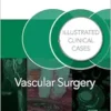 Vascular Surgery: Illustrated Clinical Cases (PDF)