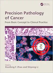 Precision Pathology Of Cancer: From Basic Concept To Clinical Practice (PDF)