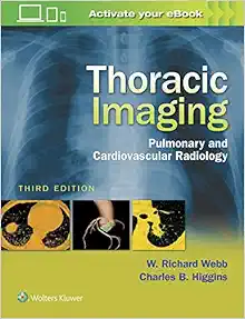 Thoracic Imaging: Pulmonary And Cardiovascular Radiology, 3rd Edition (PDF)