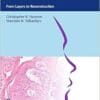 Mohs Micrographic Surgery: From Layers To Reconstruction (EPUB)